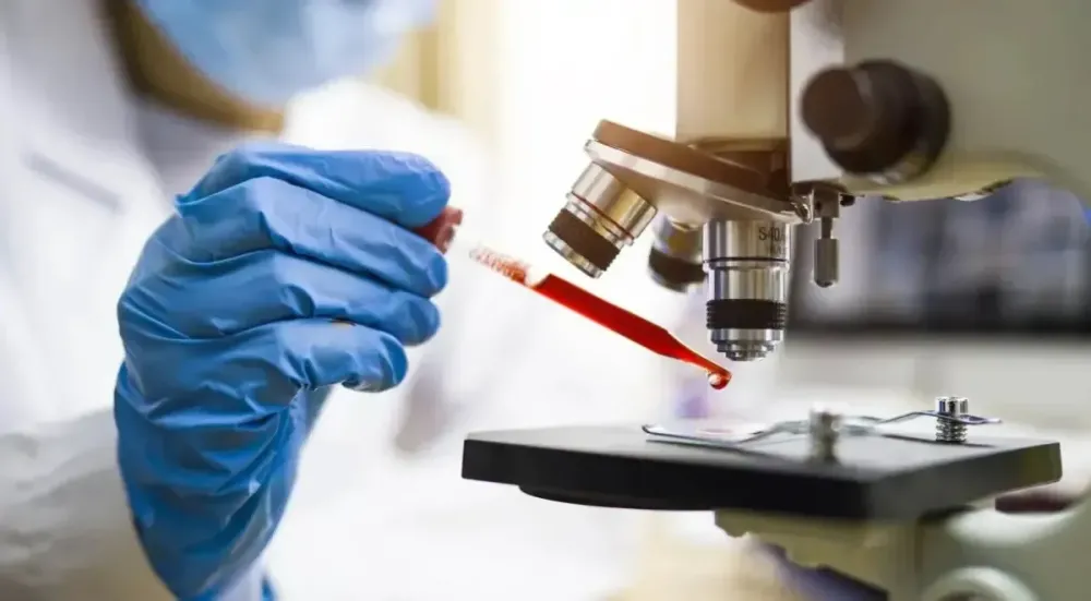 Cientistas brasileiros avançam diagnóstico de Alzheimer por exame de sangue