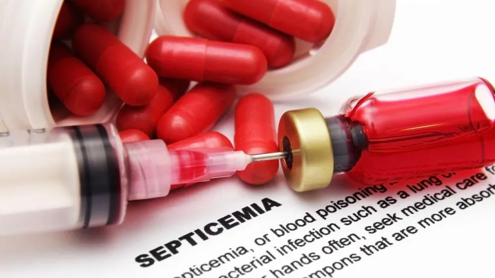 Novo medicamento reacende esperança no combate à sepse, uma das doenças mais letais