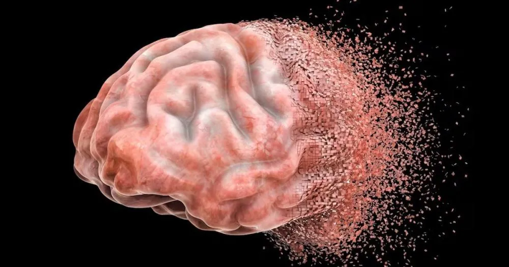 Estudo revela em tempo real como o Alzheimer danifica o cérebro