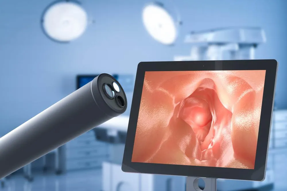 Número de exames para detecção precoce do câncer de intestino mais que dobra na última década
