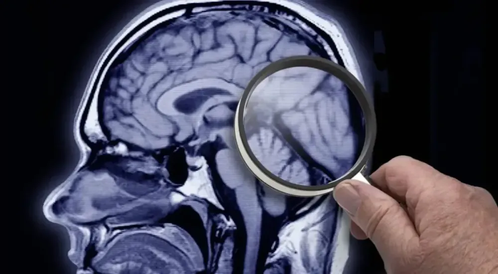 Estudo identifica proteína que acelera o avanço do Alzheimer • GSO Images/GettyImages