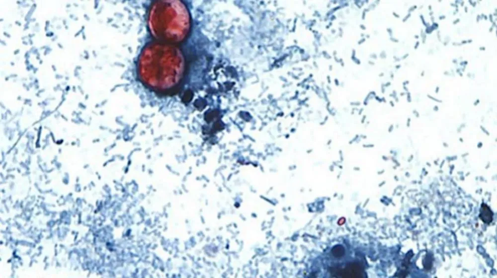 Cyclospora cayetanensis é o parasita que causa diarreia explosiva | Divulgação/CDC