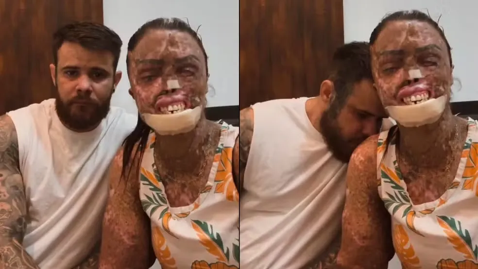 A influenciadora Káh Felipe e o marido, Edmilson Alcântara, usaram as redes sociais para falar do estado de saúde dela. — Foto: Redes sociais/Reprodução