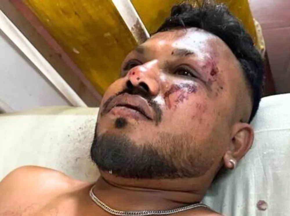 O que se sabe sobre o passageiro que saiu andando de queda de avião na Índia