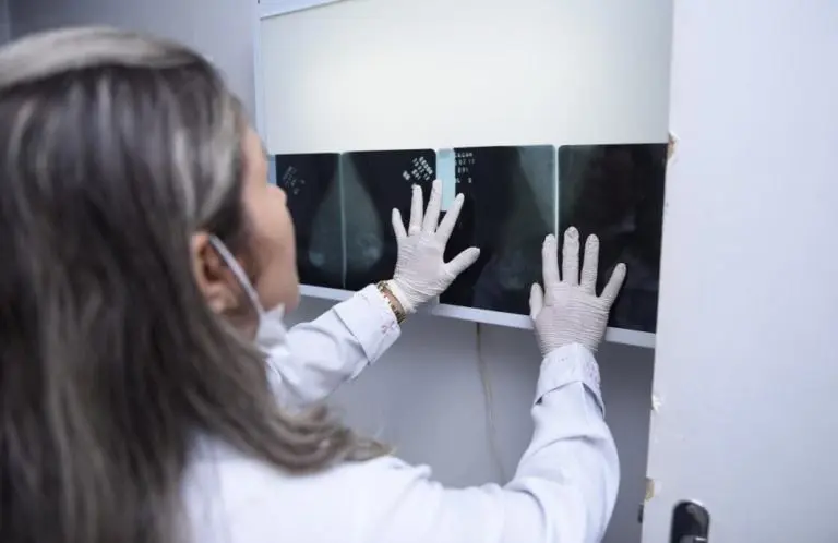 Mais de 500 mulheres deixaram de buscar resultado da mamografia no Cecon